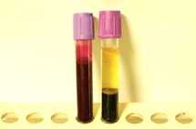 Notions de biologie Notions de biologie
