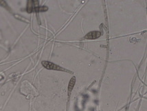 Contrôle de l'environnement du cheval : recherche de moisissures et de levures dans l'air,les aliments, les litières et les batiments. Contrôle de l'environnement du cheval : recherche de moisissures et de levures dans l'air,les aliments, les litières et les batiments.