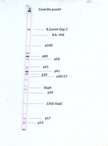 Toutes les questions que vous vous posez concernant la maladie de lyme Toutes les questions que vous vous posez concernant la maladie de lyme