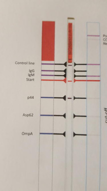 Toutes les questions que vous vous posez concernant la maladie de lyme Toutes les questions que vous vous posez concernant la maladie de lyme