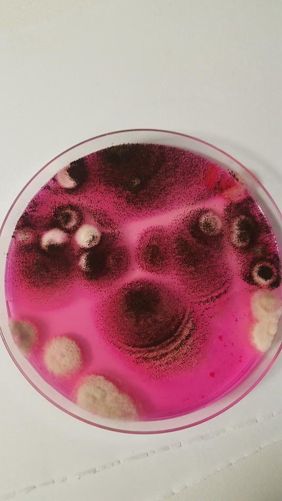 aspergillus niger dans un lavage trachéal